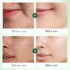 Salicylic Acid Serum + Cream