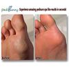 Powerful Rechargeable Electric Callus Remover-Electr
