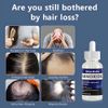 Minoxidil 5% Extra Strength Men 2 Month Supply Hair Regrowth Solution 2 Bottles