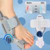 Bunion Fix ,Toe Hallux Valgus Corrector Adjustable Orthosis Women Men Splints
