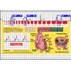R-CAT EKG Window 2nd Edition