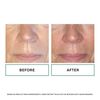 Replenix Anti-Aging Retinol 5X Regenerate Dry Serum, Medical-Grade Quick-Drying Face Serum for Mature Skin (1 fl. oz)