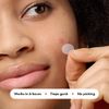 Mighty Patch Original from Hero Cosmetics - Hydrocolloid Acne Pimple Patch for Covering Zits and Blemishes, Spot Stickers for Face and Skin, Vegan-friendly and Not Tested on Animals (72 Count)