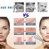 4PCS Blackhead Remover Tool Set Acne Extractor Comedone Pimples Spot and Zit