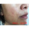 Wrinkle Queen (Trial 10 Packs) (Partial Item, No Box)
