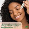 Dark Spot Treatment