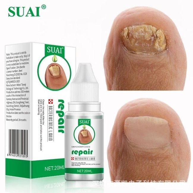 Cuticle Remover Nail Fungus Treatment Onychomycosis Serum Paronychia Anti Infection Toe Hand Foot Removal Repair Gel Care Products