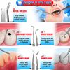 Dental Tools, Teeth Cleaning Tools, Plaque Remover for Teeth, Professional Dental Hygiene Kit, Stainless Steel Tooth Scraper Plaque Tartar Cleaner, Dental Pick Scaler Oral Care Tools Set - with Case