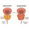 anti aging products - PROSTATE SUPPORT  Complex -2B- Maximize kidney health