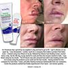 TriDerma Scar Block Soothing Clear Gel
