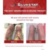 SilvrSTAT First Aid Kit Gel | 32 PPM Silver Healing Wound Dressing Solution | SilverSol Ag₄O₄ Particles | 3 oz