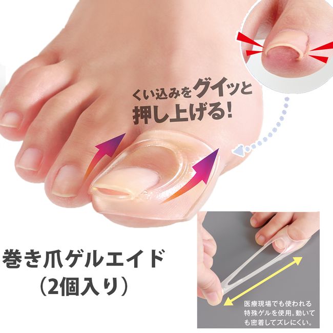 [100 yen coupon included] Ingrown toenail gel aid (2 pieces) Ingrown toenail prevention gel Ingrown toenail correction by yourself Ingrown toenail lift Ingrown toenail taping Ingrown toenail thumb Self-care Self-correction Ingrown toenail Ingrown toenail 