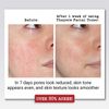 Thayers Rose Petal Witch Hazel with Aloe Vera - 12 oz.(2 pack)
