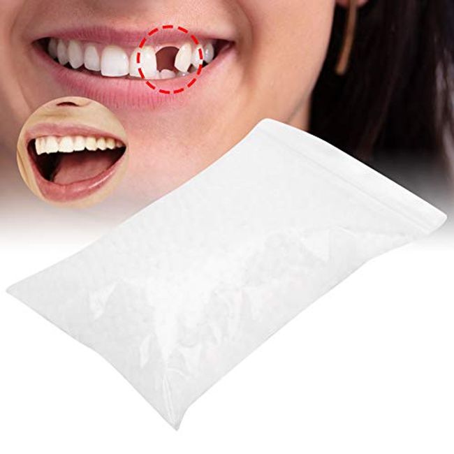 Thermal Beads for Filling Fix the Missing and Broken Tooth,Make Your Teeth  Looking Natural and Nice,100g