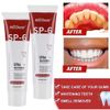 2Pcs  Probiotic SP-6 Toothpaste, Probiotics Bright Whitening Toothpaste, Sp 6