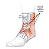 Swede-O Inner Lok 8 Ankle Brace, Black - XLarge