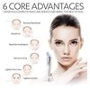 Comedo Suction Tool. Black/white Head Remover,Pore Cleanser.