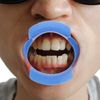 2pcs O Oral Watch Speak Orthodontics Tool Lipless Shape for Mouthguard Teeth White Orthodontic Opening Game Fun Ya Opener Blue Block Device Mouth Intraoral Autoclavable Cheek