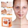 2 Pack Tumeric Soap Acne Dark Spots Removal Skin Whitening Body Bleaching Soap