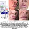 TriDerma Scar Block Soothing Clear Gel