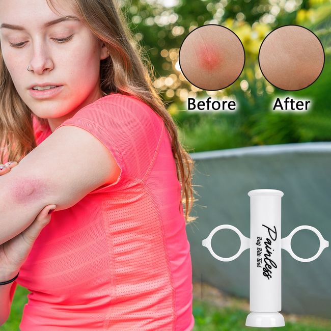 Bug Bite Sucker: Mosquito Bite Extractor