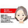 mizosutoretti-pu Nose for Under