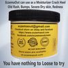 Cream Eyelid Eczema Eye eczema non steroid