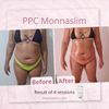 MESOLIPO PPC Cream Monnaskin 50g