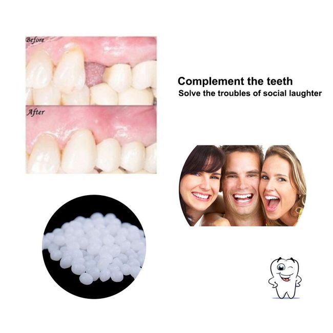 Moldable False Teeth, Tooth Replacement Kit,Temporary Teeth Repair  Kit,Tooth Repair Kit for Snap On Instant and Confident Smile,with Mouth  Mirror, 3