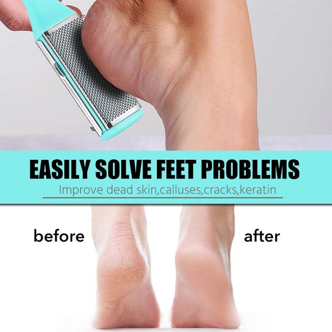 Heel Clean Pedicure Tools Callus Remover Foot Scrubber Foot File and Callus  Remover Feet Massage Brush Manicure Foot Care Tools