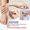 OUKEYA Urea Cream 40% for Feet and Hands, Urea Cream Foot, Foot Cream, Foot Balm, Urea Cream for Dry, Cracked Feet, Anti Callus, Urea Lotion for Hands, Heels, Elbows, Easy to Wear