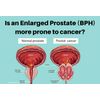 NATURAL HELP FOR ENLARGED PROSTATE (BPH) - 100% HERBAL FORMULA - MADE IN USA