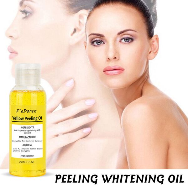 Yellow Peeling Oil  Lighten Dark Spots Acne Melanin Skin Bleaching Peeling Oil