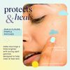 SpaLife Hydrocolloid Suns and Clouds Pimple Patches - 2 Pack