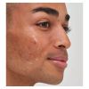 The INKEY List™ Tranexamic Acid Serum 30ml