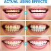 SP-6 Probiotic Whitening Toothpaste Refresh Mouth Brighten Remove Yellow Tooth