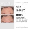 Murad Resurgence Treatment Value Set