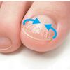 Ennail Block Corrector Single Item Medium Hard (Pack of 2)