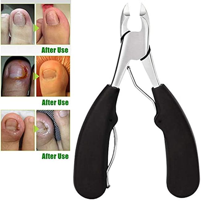 Toe Nail Clipper for Ingrown or Thick ToenailsToenails Trimmer and  Professional Podiatrist Toenail Nipper for Seniors with Surgical Stainless  Steel Surper Sharp Blades Lighter Soft Handle 1 Count (Pack of 1)