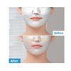 MediAnswer Pore Blue Claryfing Collagen Mask 5 Sheets