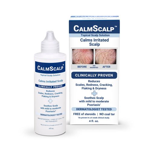 CalmScalp Topical Solution for Irritated Scalp | Improves the Appearance of Scalp with Mild to Moderate Psoriasis | Hairline Scales | Redness | Dry Scalp | Made in the USA | 4 oz.