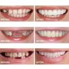 2 Pairs, Adjustable for Men and Women