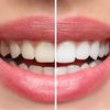 President - White Whitening Toothbrush with Ergonomic Handle