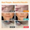 Retinol Serum for Face - Vitamin C Face Serum with Hyaluronic Acid Serum for Face, Retinol Face Anti Aging Serum, Face Serum for Women, Vitamin C Serum for Face, Brightening Serums 3x1 fl by YEOUTH