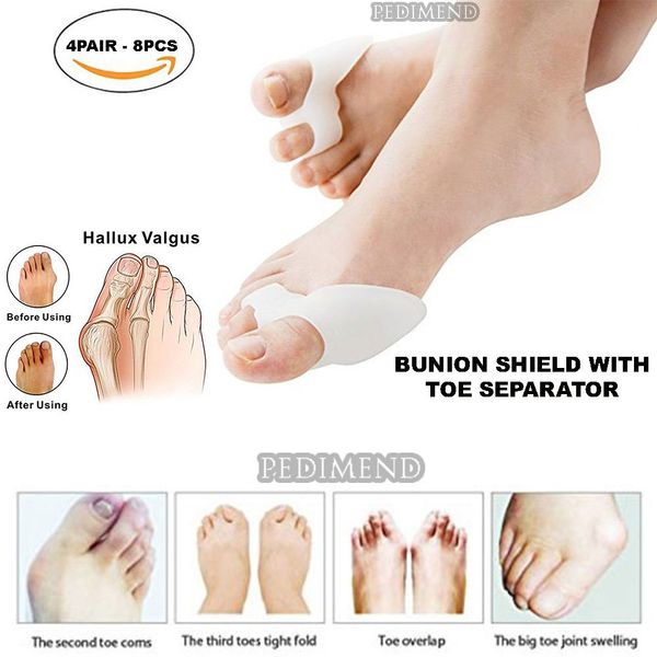 Pedimend Toe Separator with Bunion Corrector - Big Toe Alignment Support - Avoid Shoe Friction – Bunion Gel Toe Separators/Spacers/Straightener - Foot Care (Four Pairs)