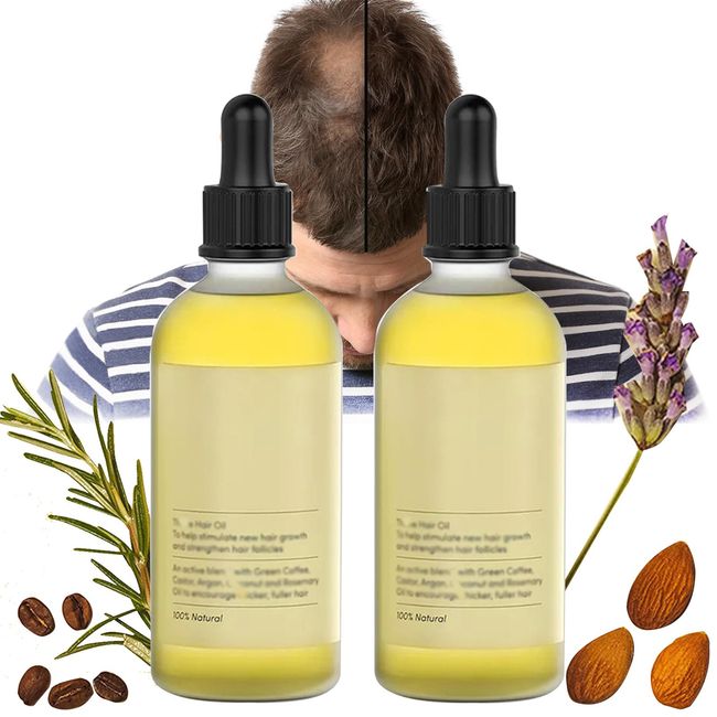 Houdini Natural Vegan Hair Growth Oil, Veganic Natural Hair Growth Oil for Dry Damaged Hair and Growth, Veganic Hair Growth Oil for Women Men Organic (2pcs)