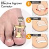 Ingrown Toenail Tool GLAMZA Corrector Clamp for Safe & Effective Treatment of Ingrown Toenail