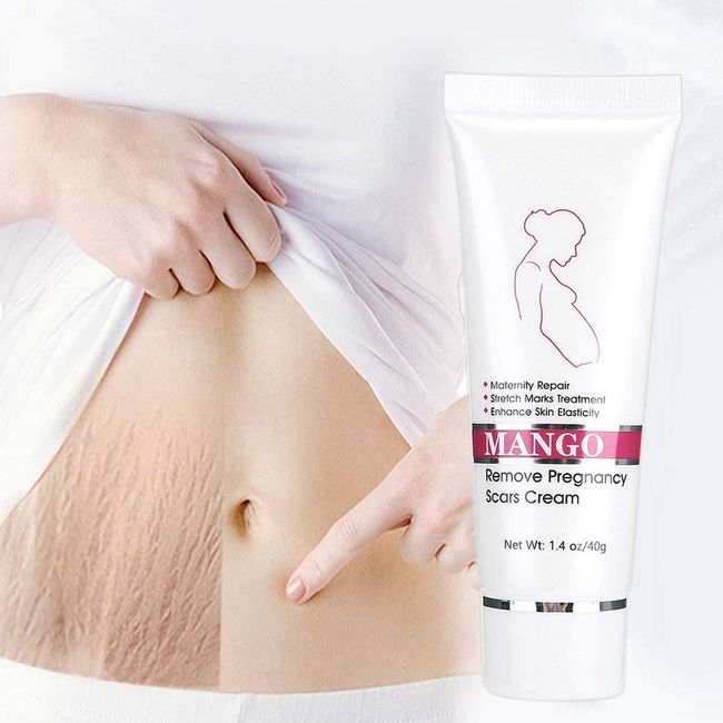 Stretch Mark Cream, Crema Para Las Estrias Crema Para Estrias De Embarazo Crema Para Eliminar Estrias Stretch Mark Cream Repair Scar Cream Removal Cream Scars Maternity Repair