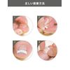 Dr. Scholl Clip for Winding Claws (Medium)