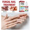Fungal Nail Treatment for Toenails Extra Strong,Nail Fungus Treatment for Toenail,Toenail Fungus Treatment,Nail Repair for Fingernails Toenails,Strengthen Renew Damaged, Broken Nails